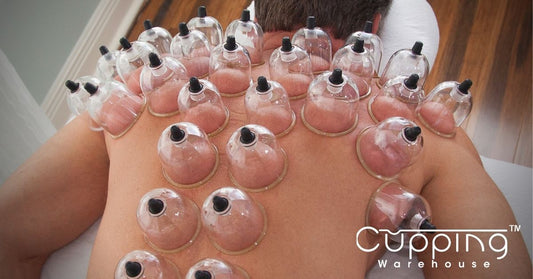 Cupping