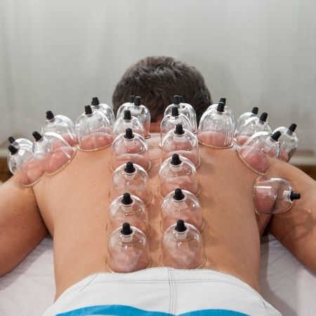 What is Cupping Therapy?
