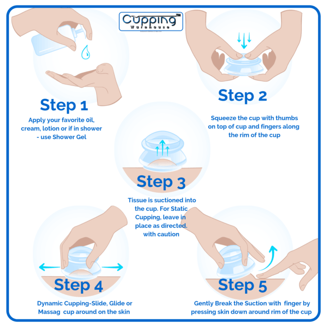 cupping, cupping therapy, face cup, therapy cups, sculpting, cupping in therapy, body shaping, cupped, cellulite, face toning, love cups, cupping benefits, massage cups, cupping massage, suction cups for therapy, cupping set