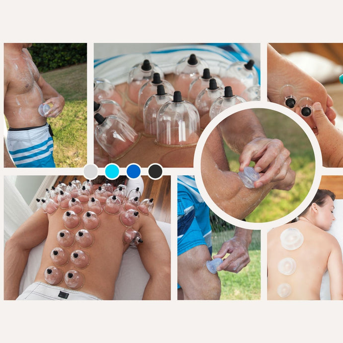 What is Cupping Therapy?
