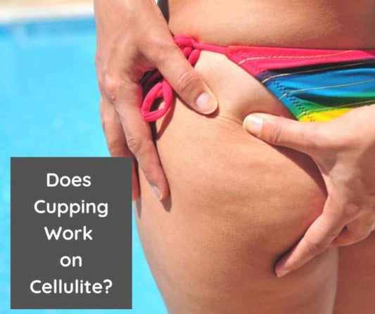 Does Cupping Work on Cellulite? - Cupping Warehouse