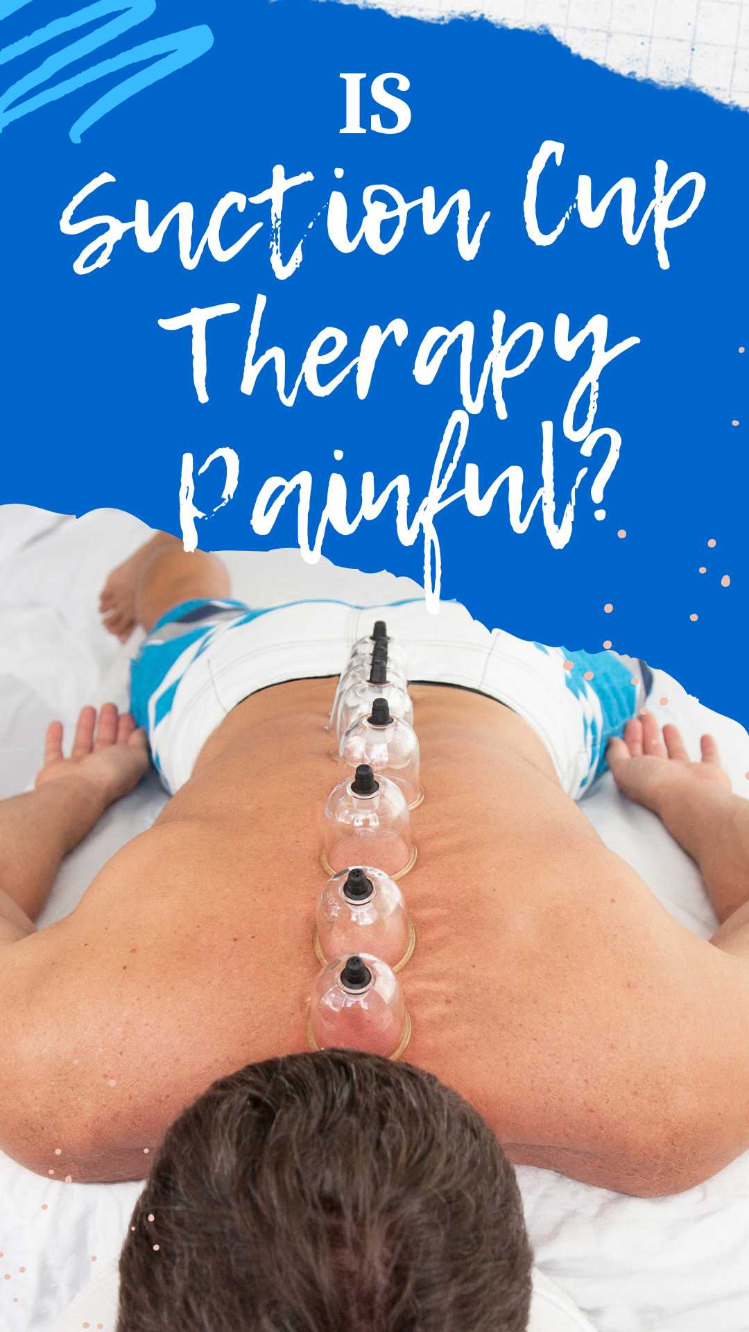 Is Suction Cup Therapy Painful?