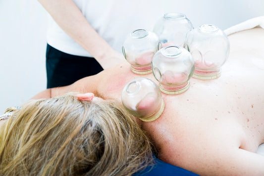 The Different Types of Cupping Therapy: Which One Is Right for You?