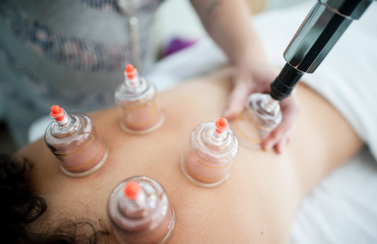Cupping Therapy for Pain Relief: A Natural Alternative to Traditional Medicine