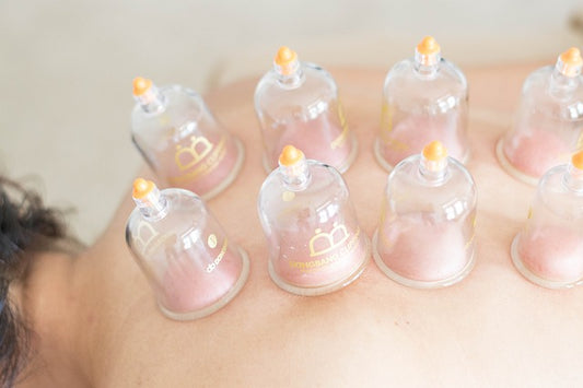 How to Prepare for Your Cupping Therapy Session: Tips and Considerations