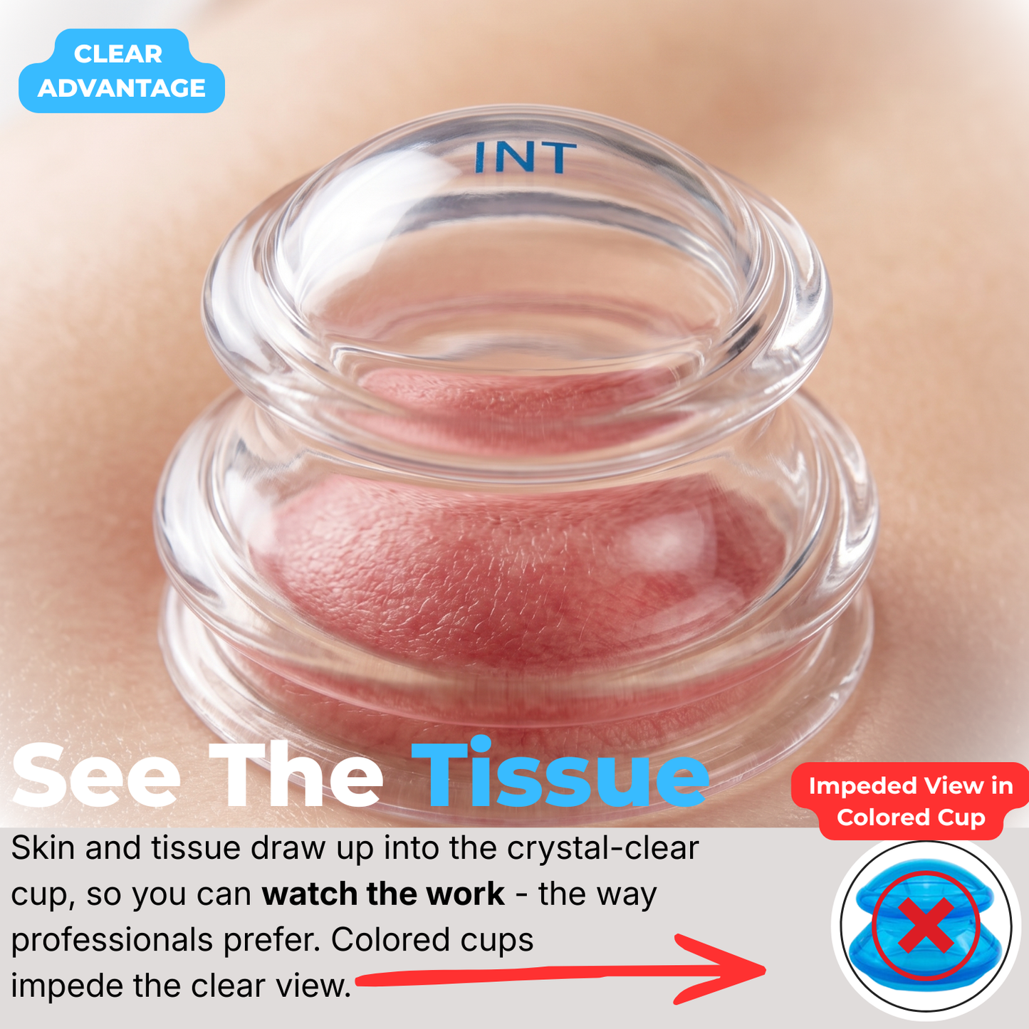 Supreme 4 Intermediate Pro 5560 — (4 Sizes: S, M, L, XL)Soft, Easy-Squeeze Silicone Cupping Set for Beginners & Self-Care