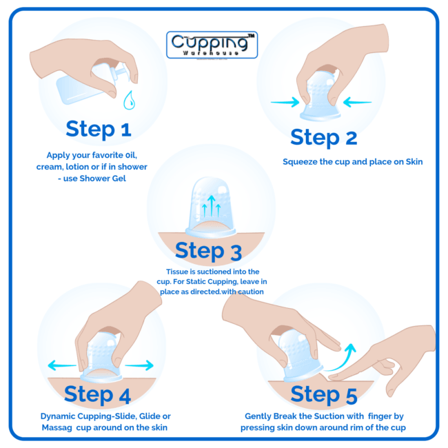 cupping, cupping therapy, face cup, therapy cups, sculpting, cupping in therapy, body shaping, cupped, cellulite, face toning, love cups, cupping benefits, massage cups, cupping massage, suction cups for therapy, cupping set